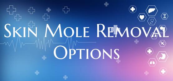 Skin Mole Removal Options