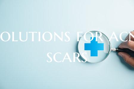 Solutions for acne scars