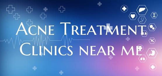 Acne Treatment Clinics near me