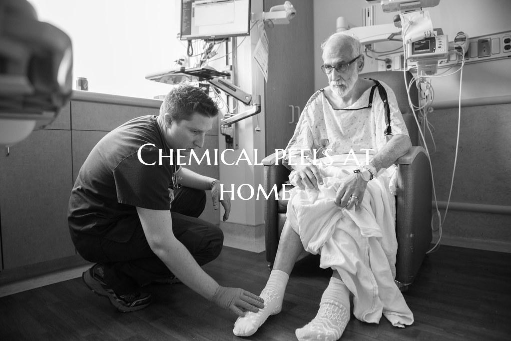 Chemical peels at home