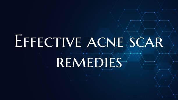 Effective acne scar remedies